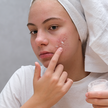 Spot treatment precision